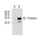Frataxin Antibody (G-12) - Western Blotting - Image 393528 