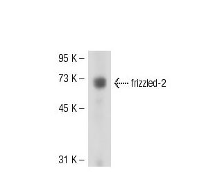 frizzled-2 Antibody (K19R) - Western Blotting - Image 51775