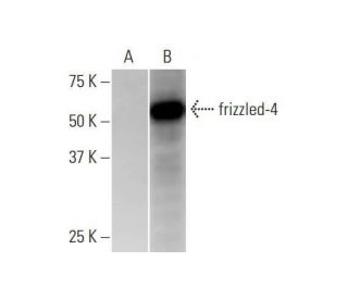 frizzled-4 Antibody (3G7) - Western Blotting - Image 352165 