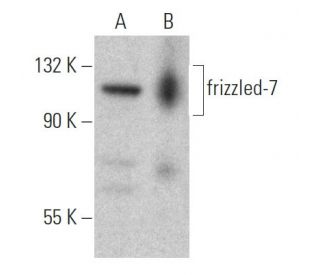 frizzled-7 Antibody (4D9) - Western Blotting - Image 367984The Double Nickase Plasmid features a U6 promoter for sgRNA expression, a 20 nt targeting sequence, and a gRNA scaffold to guide Cas9n. It includes a CBh promoter for Cas9n (D10A) and puromycin resistance, GFP for transfection verification, and nuclear localization signals (NLS). The 2A peptide allows co-expression of Cas9n and Puro from a single promoter, enabling precise genome editing with reduced off-target effects.