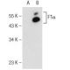 FTα Antibody (C-4) - Western Blotting - Image 146788