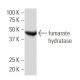 fumarate hydratase Antibody (J-13) - Western Blotting - Image 34117 