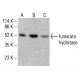 fumarate hydratase Antibody (J-13) - Western Blotting - Image 412744