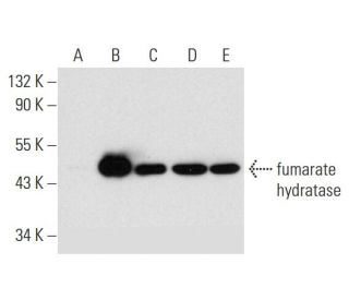 fumarate hydratase Antibody (H-6) - Western Blotting - Image 300104