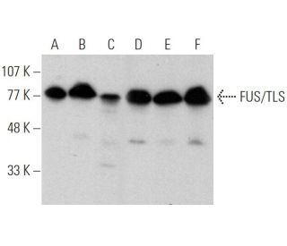 FUS/TLS Antibody (4H11) - Western Blotting - Image 370753 