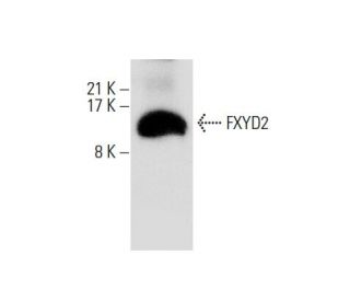 FXYD2 Antibody (ZW-5) - Western Blotting - Image 301559 