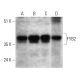 FYB2 Antibody (G-6) - Western Blotting - Image 333572 