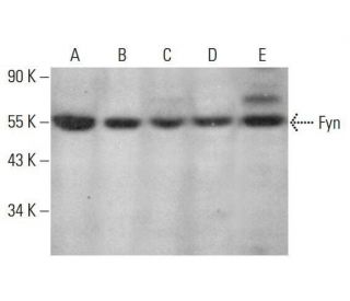 Fyn Antibody (E-12) - Western Blotting - Image 351958 