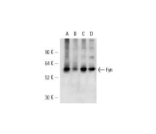 Fyn Antibody (FYN-01) - Western Blotting - Image 12833 