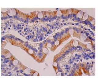 G-CSF Antibody (3D1) - Immunohistochemistry - Image 284750 