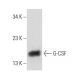 G-CSF Antibody (3D1) - Western Blotting - Image 13595 