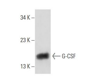 G-CSF Antibody (3D1) - Western Blotting - Image 13595SAM Transcription Activation: SAM system utilizing dCas9-VP64, MS2-P65-HSF1, and sgRNA for precise gene transcription activation.