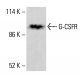 G-CSFR Antibody (A-7) - Western Blotting - Image 415696