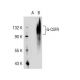 G-CSFR Antibody (R12) - Western Blotting - Image 36416
