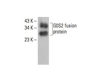 G0S2 Antibody (D-1) - Western Blotting - Image 393036