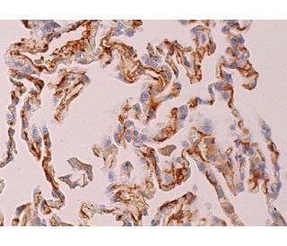 G2A Antibody (G-5) - Immunohistochemistry - Image 370326 