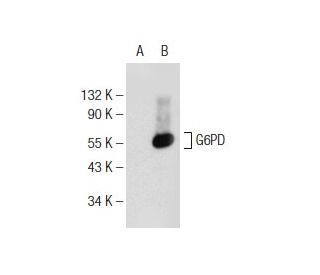 G6PD Antibody (G-12) - Western Blotting - Image 146836