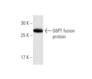 G6PT Antibody (7B9) - Western Blotting - Image 348486 