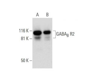 GABA<sub>B</sub> R2 Antibody (H-10) - Western Blotting - Image 294456 