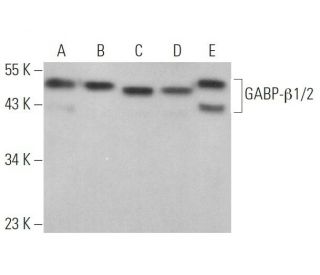 GABP-&beta;1/2 Antibody (11) - Western Blotting - Image 373131 