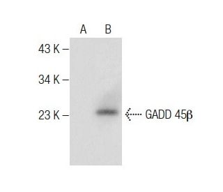 GADD 45β Antibody (G-11) - Western Blotting - Image 283467SAM Transcription Activation: SAM system utilizing dCas9-VP64, MS2-P65-HSF1, and sgRNA for precise gene transcription activation.
