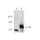 GAK Antibody (D-2) - Western Blotting - Image 56268 