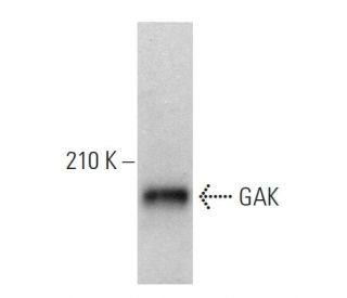 GAK Antibody (G-10) - Western Blotting - Image 359266 