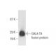GAL4-TA Antibody (A-2) - Western Blotting - Image 11002