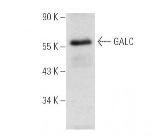 GALC Antibody (G-6) - Western Blotting - Image 390857The Double Nickase Plasmid features a U6 promoter for sgRNA expression, a 20 nt targeting sequence, and a gRNA scaffold to guide Cas9n. It includes a CBh promoter for Cas9n (D10A) and puromycin resistance, GFP for transfection verification, and nuclear localization signals (NLS). The 2A peptide allows co-expression of Cas9n and Puro from a single promoter, enabling precise genome editing with reduced off-target effects.