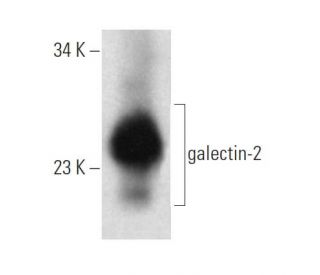 galectin-2 Antibody (C6) - Western Blotting - Image 374572 