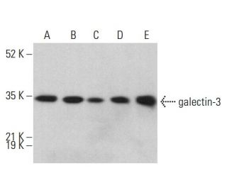 galectin-3 Antibody (A3A12) - Western Blotting - Image 377121 