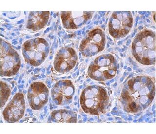 galectin-3 Antibody (M3/38) - Immunohistochemistry - Image 356380 