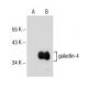 galectin-4 Antibody (C-6) - Western Blotting - Image 154926 