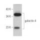 galectin-4 Antibody (C-6) - Western Blotting - Image 365471