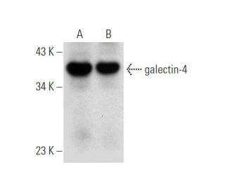 galectin-4 Antibody (E-2) - Western Blotting - Image 319527 