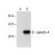 galectin-4 Antibody (F-1) - Western Blotting - Image 157513