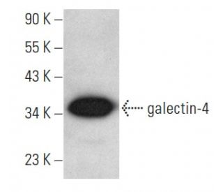 galectin-4 Antibody (D-11) - Western Blotting - Image 354408