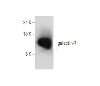 galectin-7 Antibody (A-8) - Western Blotting - Image 325099 