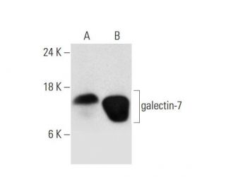 galectin-7 Antibody (F-3) - Western Blotting - Image 325098 