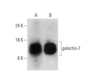 galectin-7 Antibody (G-3) - Western Blotting - Image 325100 