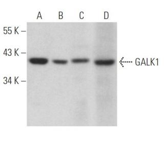 GALK1 Antibody (F-3) - Western Blotting - Image 366272