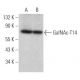 GalNAc-T14 Antibody (C-5) - Western Blotting - Image 367421