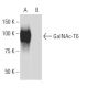 GalNAc-T6 Antibody (Y5J) - Western Blotting - Image 34130