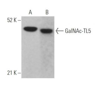 GalNAc-TL5 Antibody (F-5) - Western Blotting - Image 369074 
