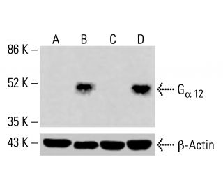 G<sub>α 12</sub> Antibody (B-5) - Western Blotting - Image 416052