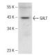 GALT Antibody (G-1) - Western Blotting - Image 142616 