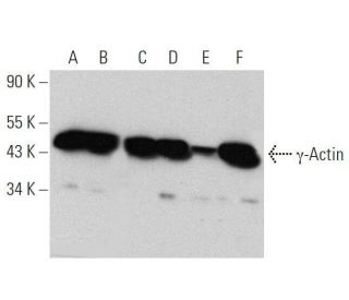 &gamma;-Actin Antibody (1-17) - Western Blotting - Image 359410 