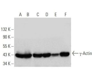 &gamma;-Actin Antibody (1-24) - Western Blotting - Image 359406 