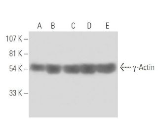 &gamma;-Actin Antibody (2-4) - Western Blotting - Image 15781 
