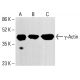 γ-Actin Antibody (2-4) - Western Blotting - Image 413229